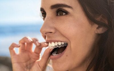 Tannregulering med Invisalign™ – tilbys av både kjeveortopeder og allmenntannleger