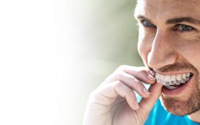 Hvordan foregår behandlingen med Invisalign